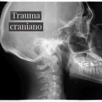 trauma craniano.png